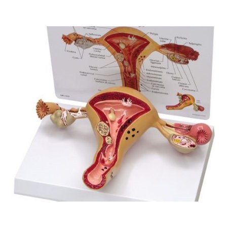 GPI ANATOMICAL Anatomical Model - Uterus - Ovary 3480